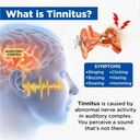 acupeace-tinnitus-relief-device-acupeace-2.jpg