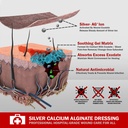 everlit-ag-silver-calcium-alginate-wound-3.jpg