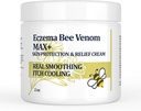 Crème de venin d'abeille à haute résistance, onguent dyshidrotique, rash thermique, démangeaisons, eczéma, psoriasis, jambe, estomac, pied, main, peau irritée, soins tout âge